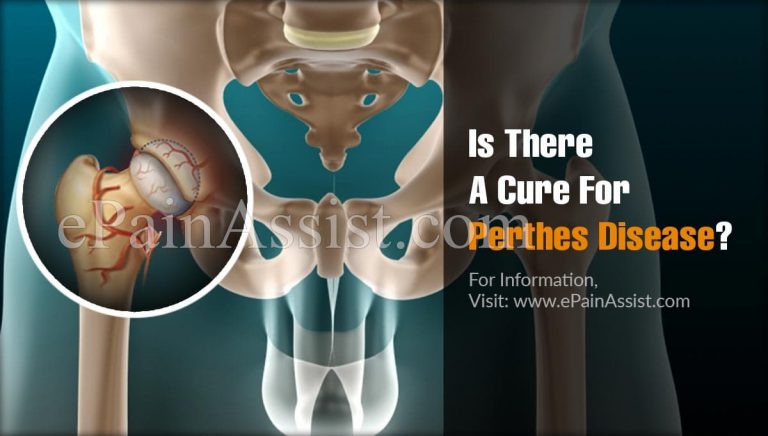 Is There A Cure For Perthes Disease?
