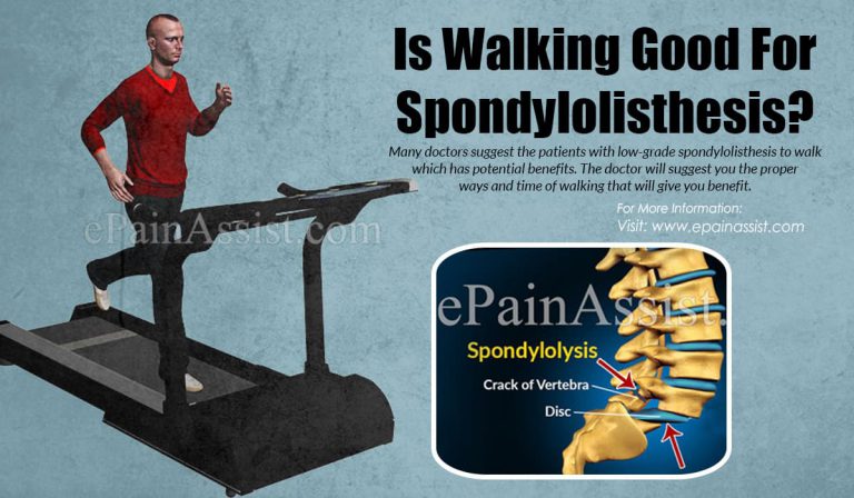 Is Walking Good For Spondylolisthesis?