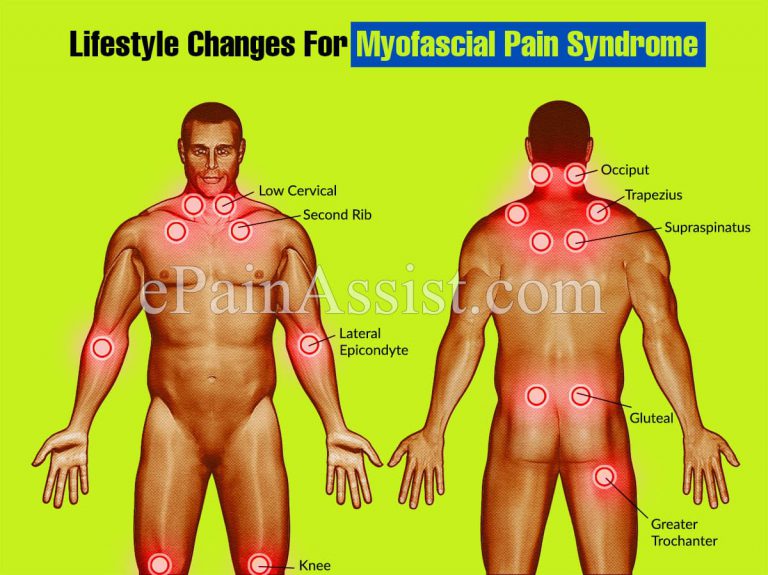 Lifestyle Changes For Myofascial Pain Syndrome