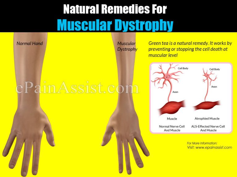 Natural Remedies For Muscular Dystrophy