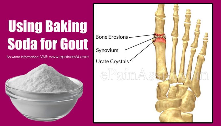 Using Baking Soda for Gout: Is It Effective?