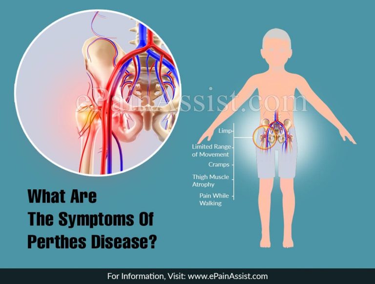 What Are The Symptoms Of Perthes Disease?