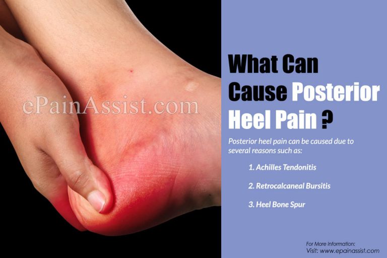What Can Cause Posterior Heel Pain & How is it Treated?
