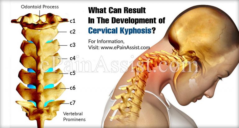 What Can Result In The Development of Cervical Kyphosis?