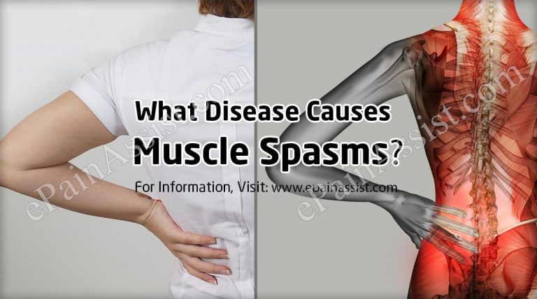 What Disease Causes Muscle Spasms?
