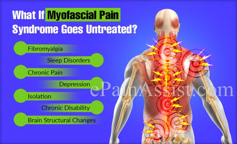What If Myofascial Pain Syndrome Goes Untreated?