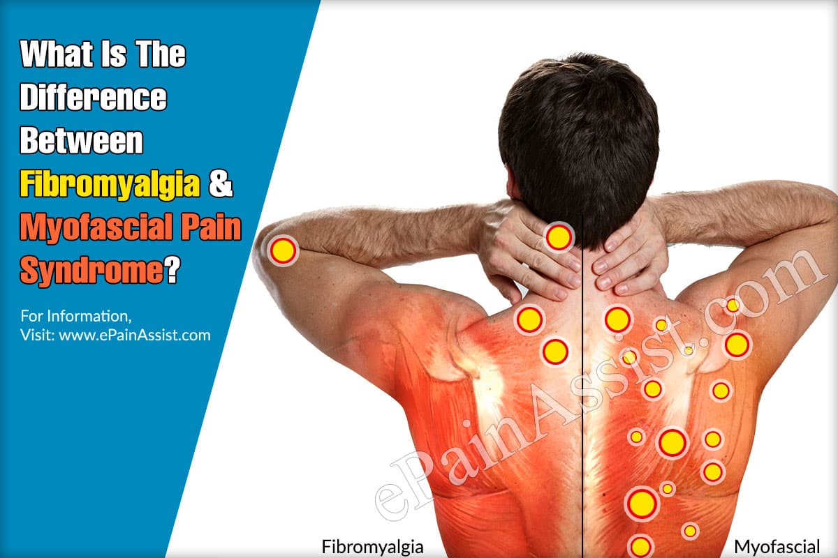 What Is The Difference Between Fibromyalgia And Myofascial Pain Syndrome?