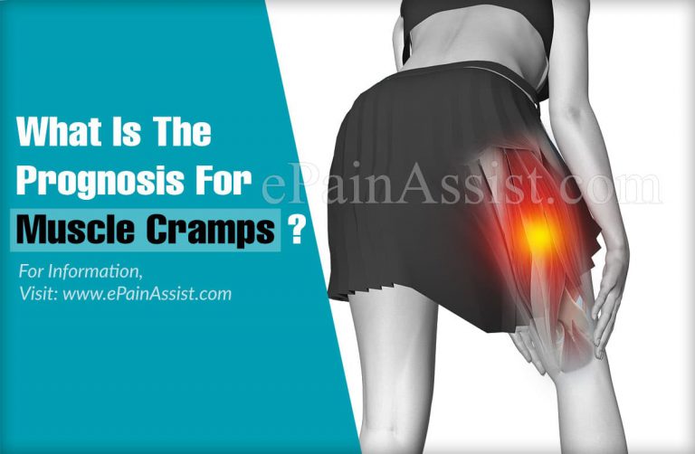 What Is The Prognosis For Muscle Cramps?