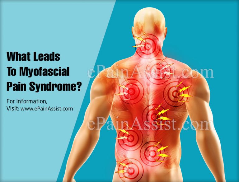 What Leads To Myofascial Pain Syndrome?