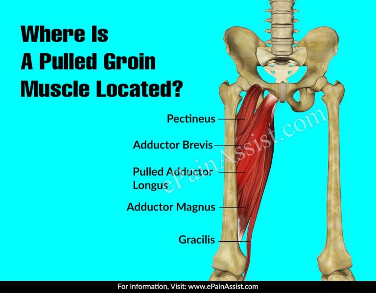 Where Is A Pulled Groin Muscle Located?|Best Yoga Poses For Pulled Groin