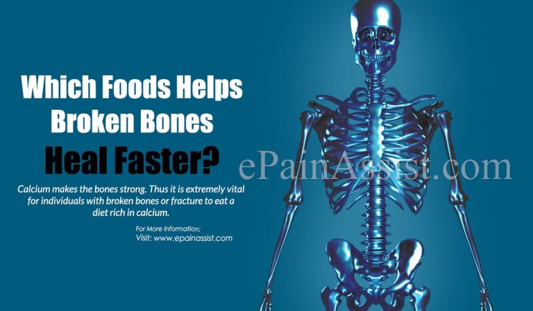 Which Foods Helps Broken Bones Heal Faster?