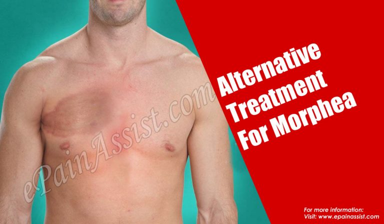 Alternative Treatment For Morphea