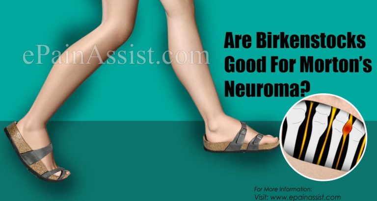 Are Birkenstocks Good For Morton’s Neuroma?