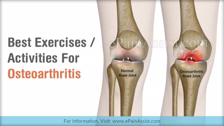 Best Exercises/Activities For Osteoarthritis
