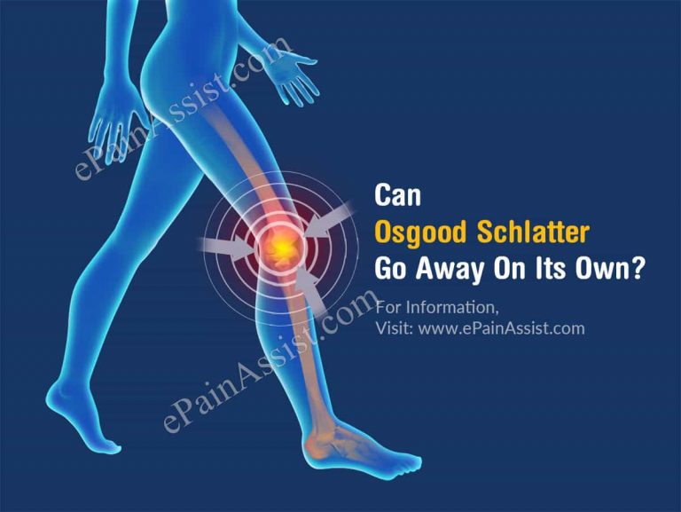 Can Osgood Schlatter Go Away On Its Own & What Are Its Natural Remedies?