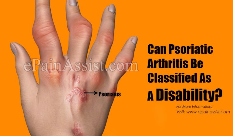 Can Psoriatic Arthritis Be Classified As A Disability?