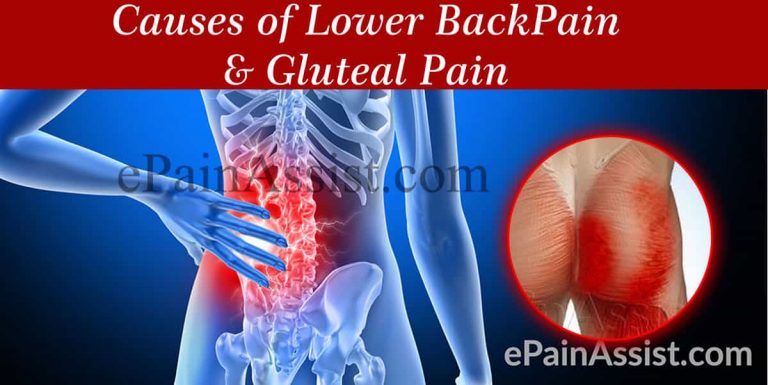 Cause of Lower Back and  Gluteal Pain & Ways To Get Rid Of It
