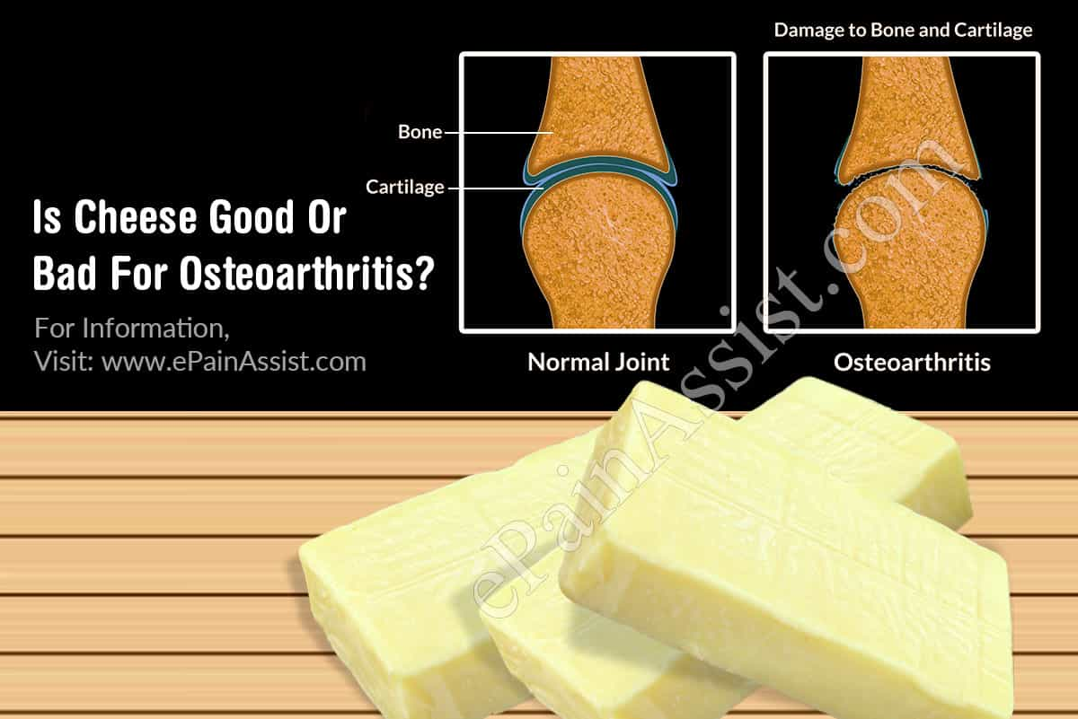 Is Cheese Good Or Bad For Osteoarthritis?