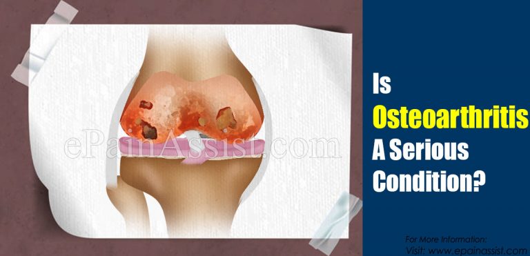 Is Osteoarthritis A Serious Condition & Can It Be Reversed?