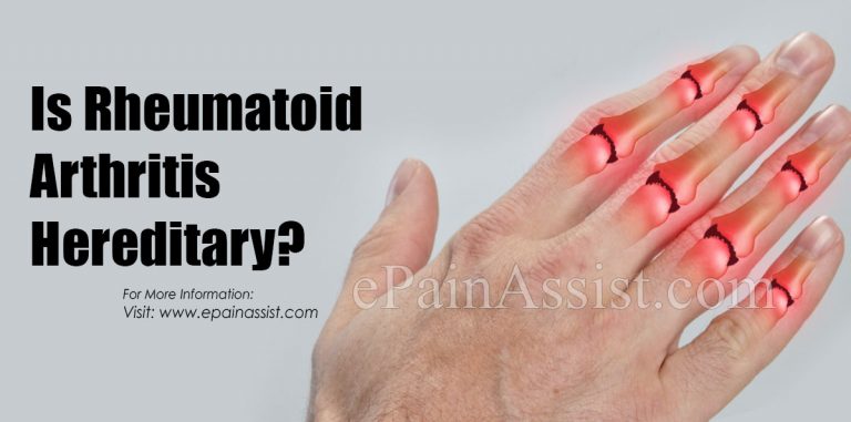 Is Rheumatoid Arthritis Hereditary?