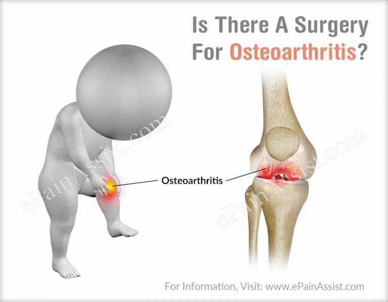 Is There A Surgery For Osteoarthritis?