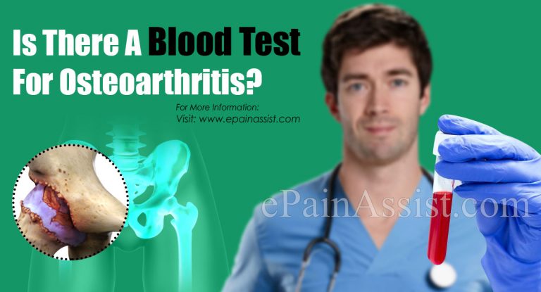 Who Is At Risk For Osteoarthritis & Is There A Blood Test For It?