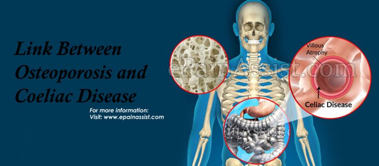 Link Between Osteoporosis and Coeliac Disease