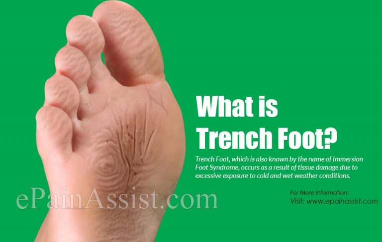 Trench Foot: Causes, Symptoms, Treatment