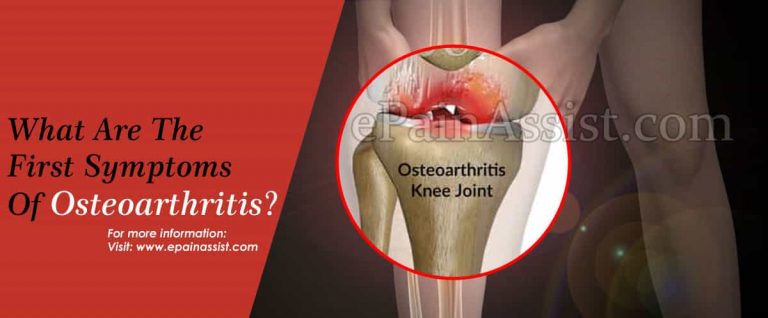 What Are The First Symptoms Of Osteoarthritis & How Do Doctors Check For It?