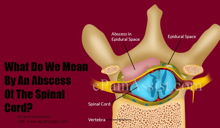 What Can Cause An Abscess On The Spinal Cord?