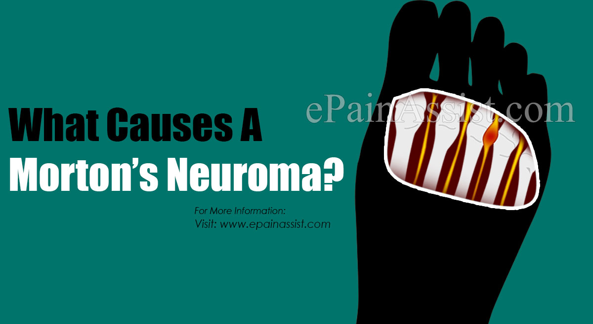 What Causes A Morton's Neuroma?