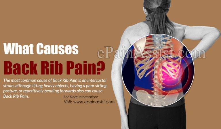Back Rib Pain: Causes & Management