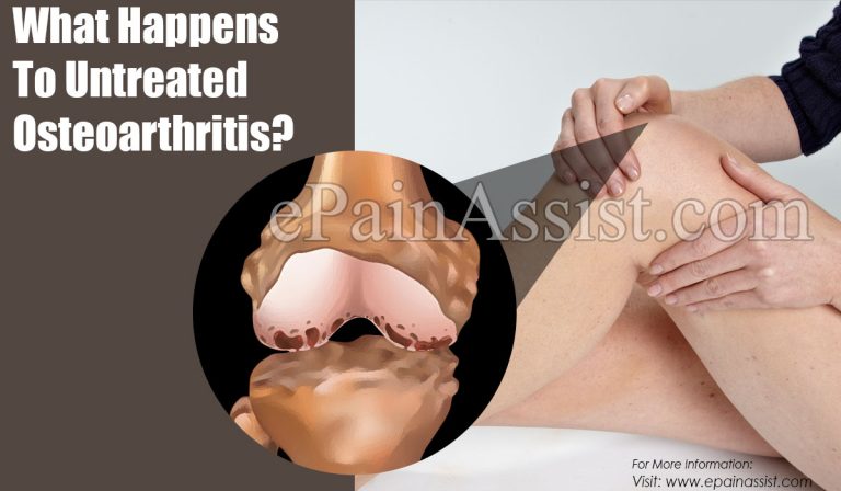 What Happens To Untreated Osteoarthritis & When To Go To Doctor?