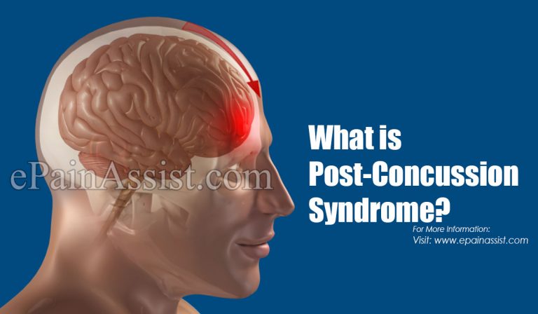 What is Post-Concussion Syndrome & Can It Be Treated?