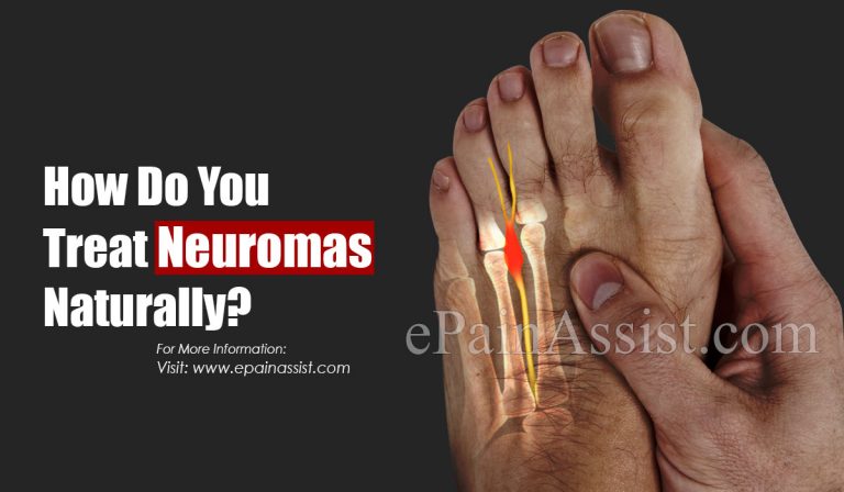 What Is The Major Cause Of Neuroma?