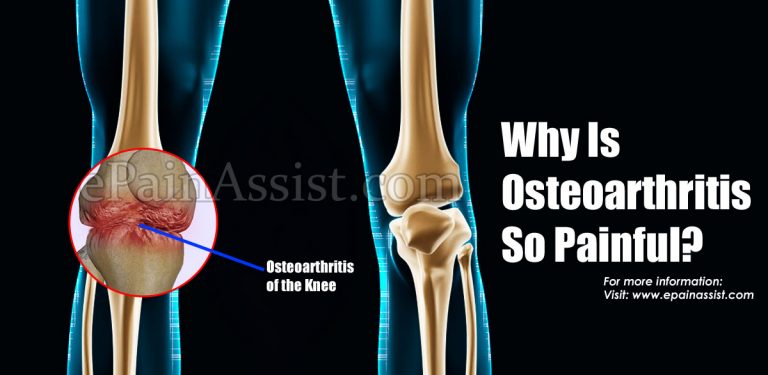 Why Is Osteoarthritis So Painful & How Bad Can It Get?