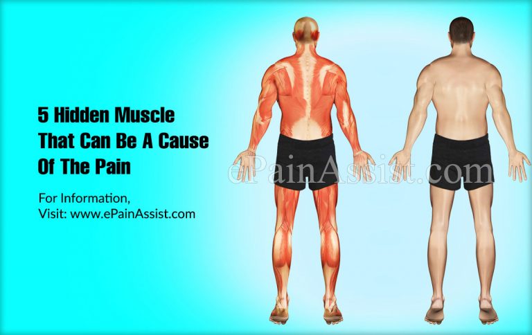 5 Hidden Muscle That Can Be A Cause Of The Pain