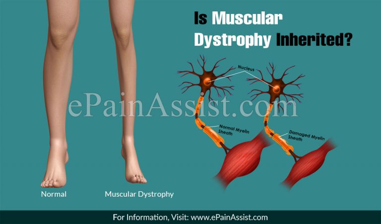 Is Muscular Dystrophy Inherited?