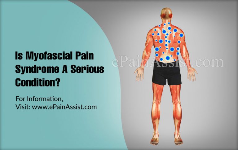 Is Myofascial Pain Syndrome A Serious Condition?
