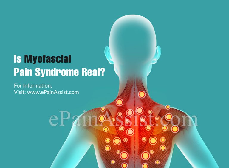 Is Myofascial Pain Syndrome Real?