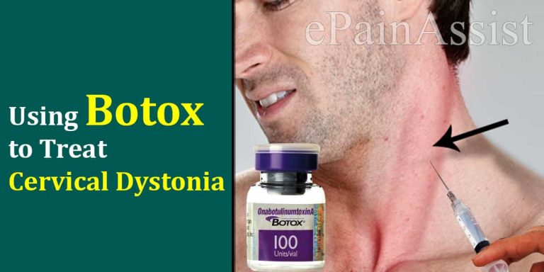 Using Botox to Treat Cervical Dystonia