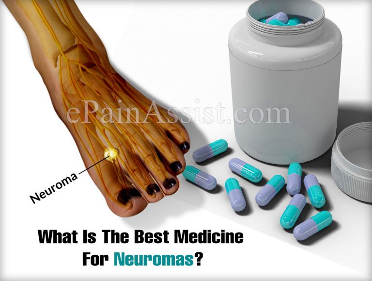 What Is The Best Medicine For Neuromas?