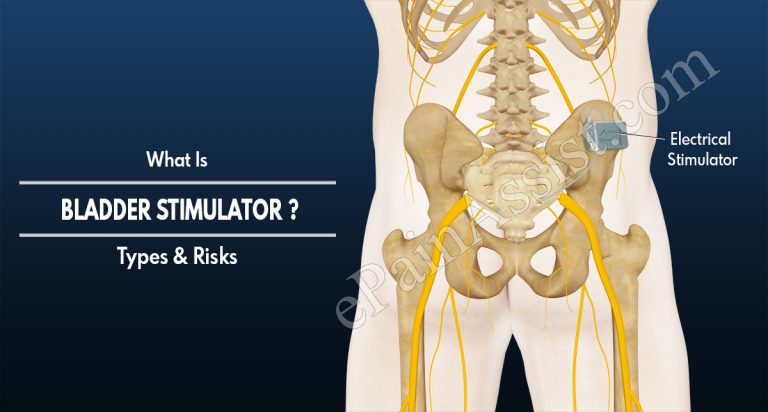 Bladder Stimulator: Types & Risks