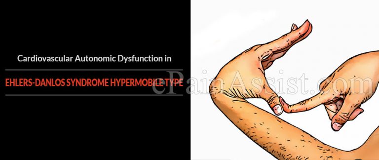 Cardiovascular Autonomic Dysfunction in Ehlers-Danlos Syndrome Hypermobile Type
