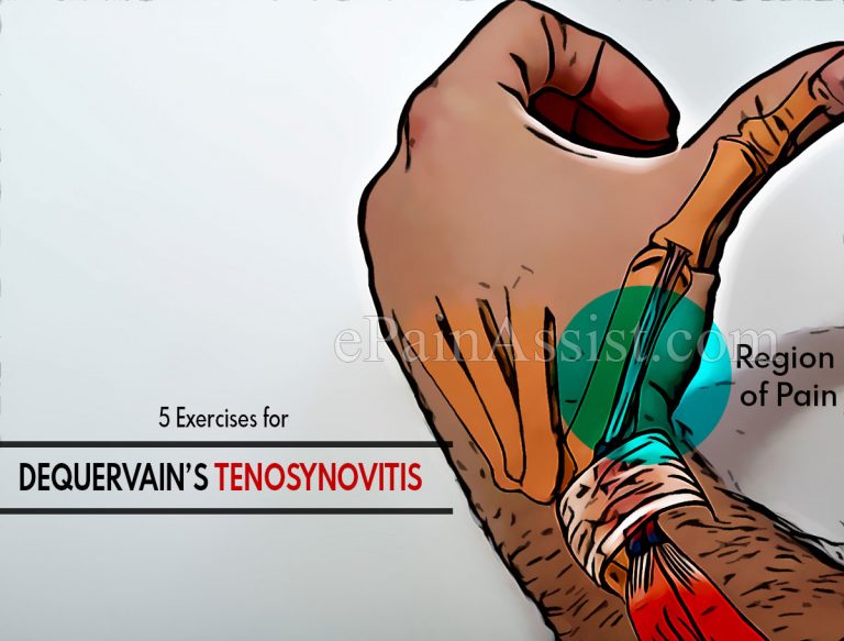 5 Exercises for DeQuervain’s Tenosynovitis
