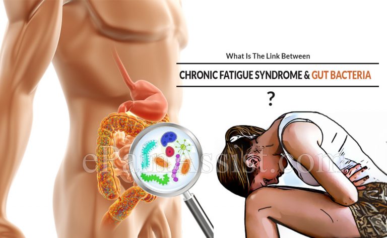 What Is The Link Between Chronic Fatigue Syndrome and Gut Bacteria?