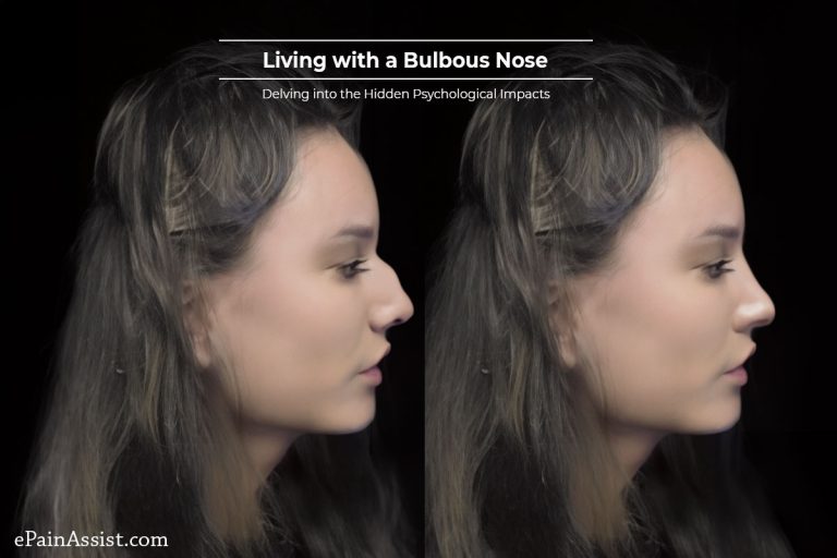 Living with a Bulbous Nose : Delving into the Hidden Psychological Impacts