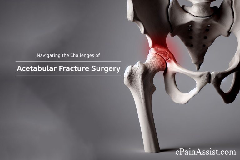 Navigating the Challenges of Acetabular Fracture Surgery : Techniques and Outcomes