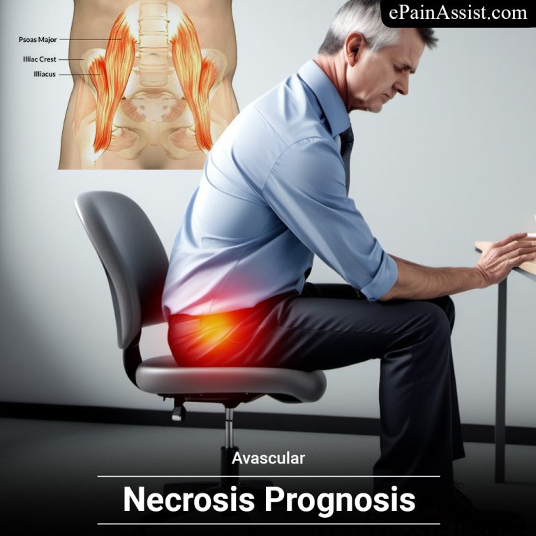 Avascular Necrosis Prognosis