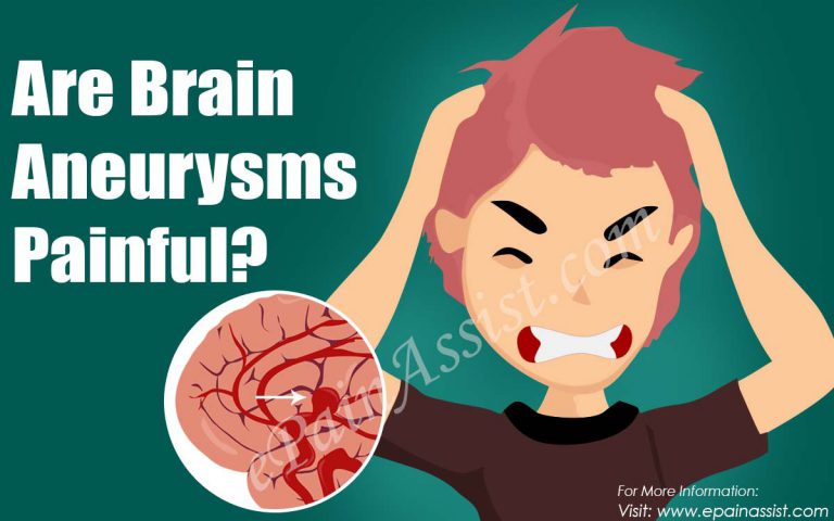 Are Brain Aneurysms Painful?